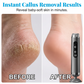 🔥50% off for a limited time⏰Multi-Function Electric Foot Grinder with 5 Speeds